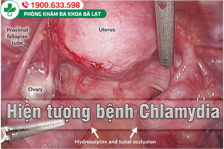 Hình ảnh minh họa